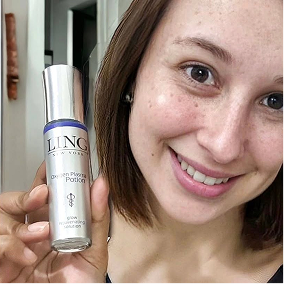 Acne-prone