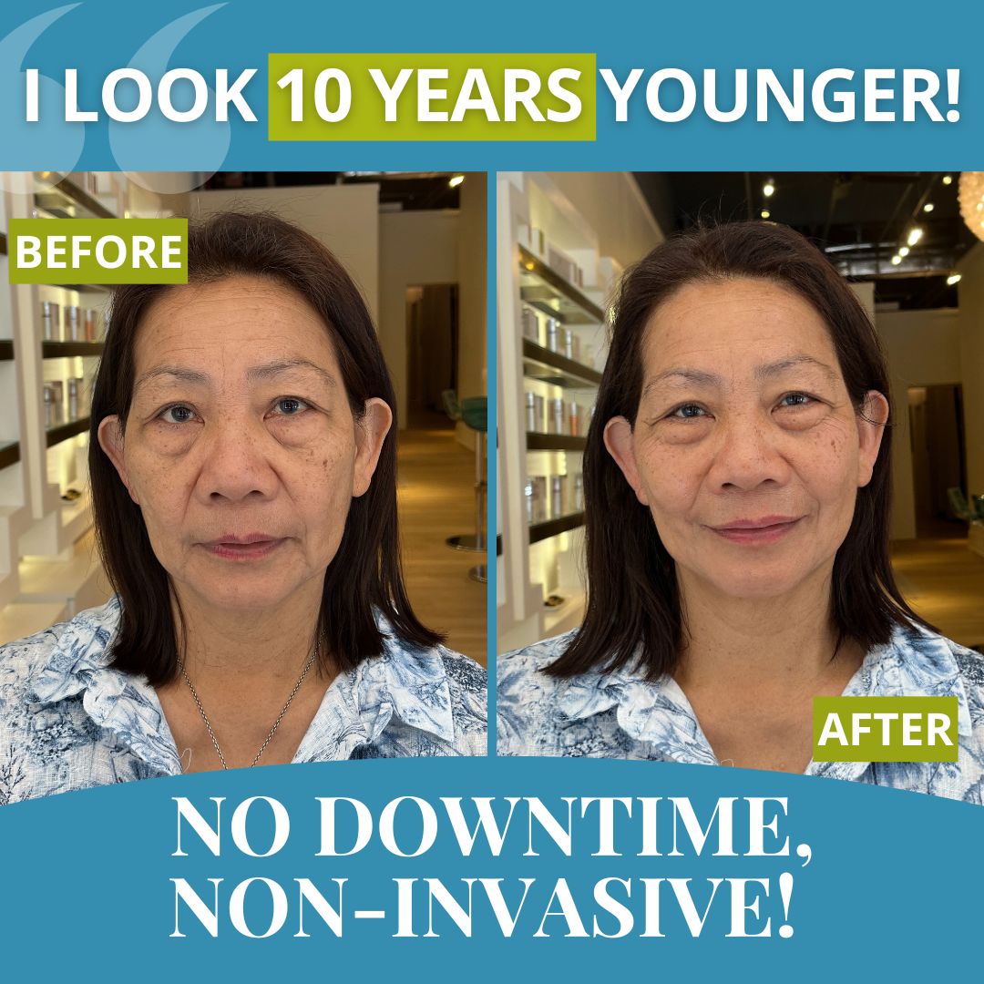 LING Instant Energy Lift - friends & family special offer